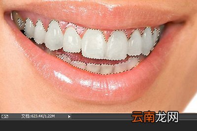 PS牙齿如何变白 变白方法推荐