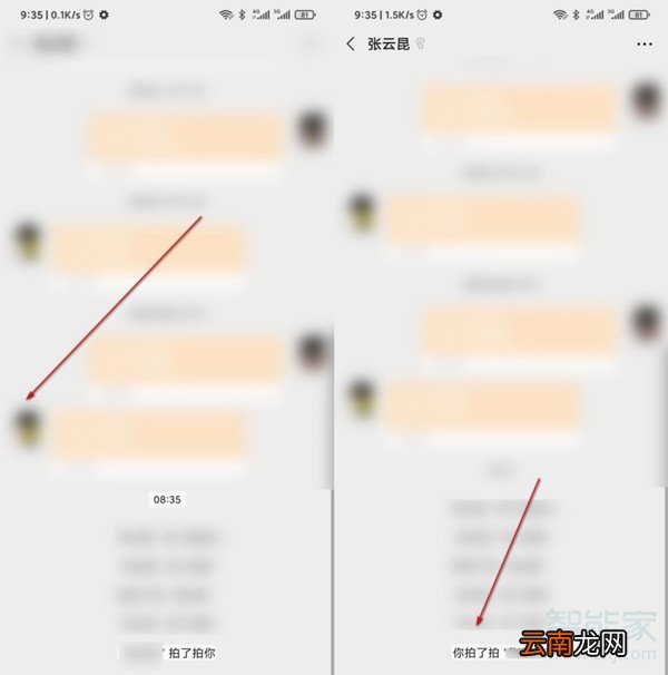 小米手机微信拍一拍设置